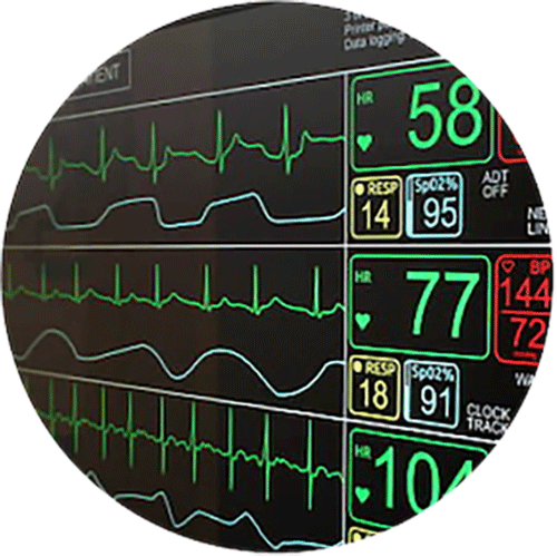 Heart Monitor Image